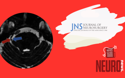 Significance of degree of neurovascular compression in surgery for trigeminal neuralgia