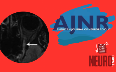 COVID-19–Associated Miller Fisher Syndrome: MRI Findings