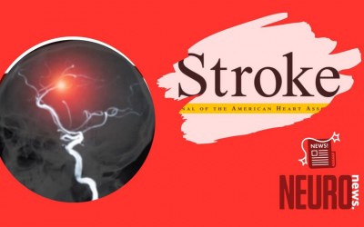 Modifiable Lifestyle Factors and Risk of Stroke