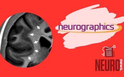 Update on Adult Epilepsy: What Neuroradiologists Should Know