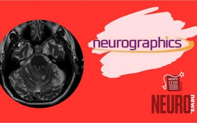 Glioneuronal and Neuronal Tumors: Who? When? Where? An Update Based on the 2021 World Health Organization Classification