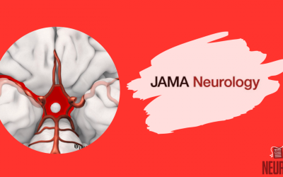 EARLYDRAIN: Effectiveness of Lumbar Cerebrospinal Fluid Drain Among Patients With Aneurysmal Subarachnoid Hemorrhage